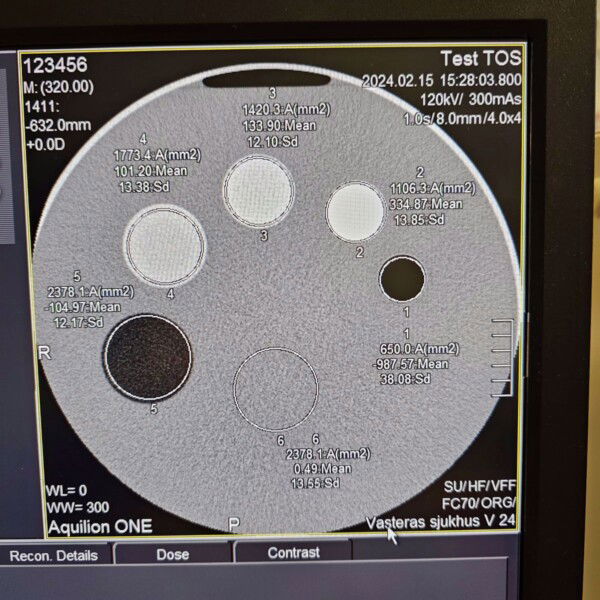 Toshiba Aquilion One Vision Edition - 2015