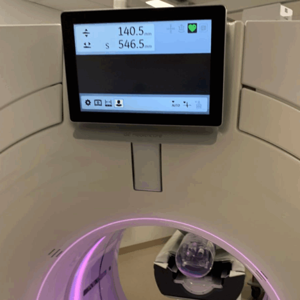 GE Revolution Apex 256 - 2014