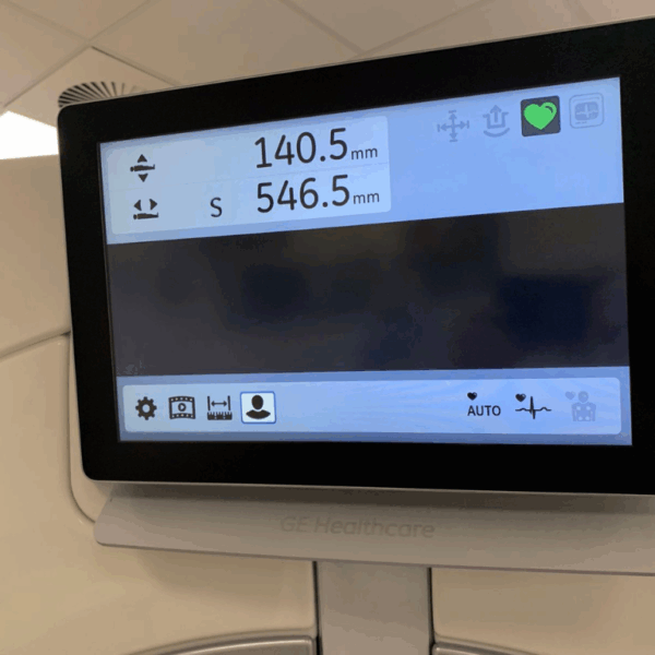 GE Revolution Apex 256 - 2014