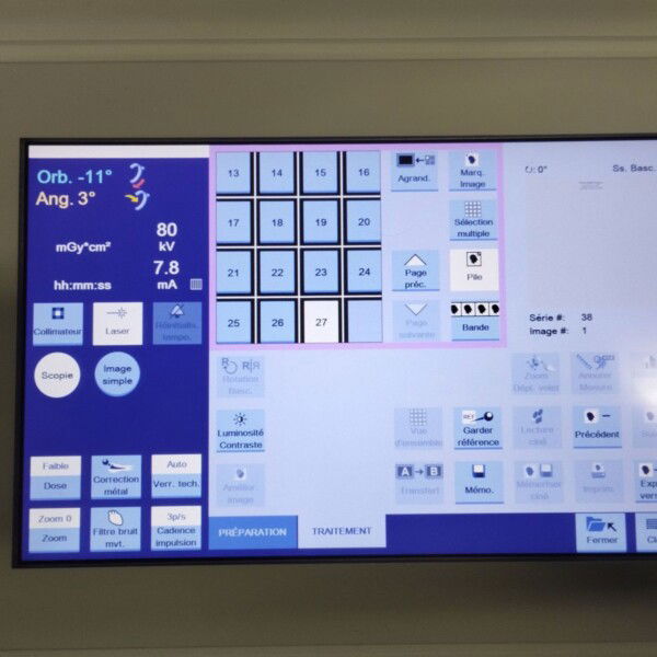 Siemens Cios Alpha - 2020